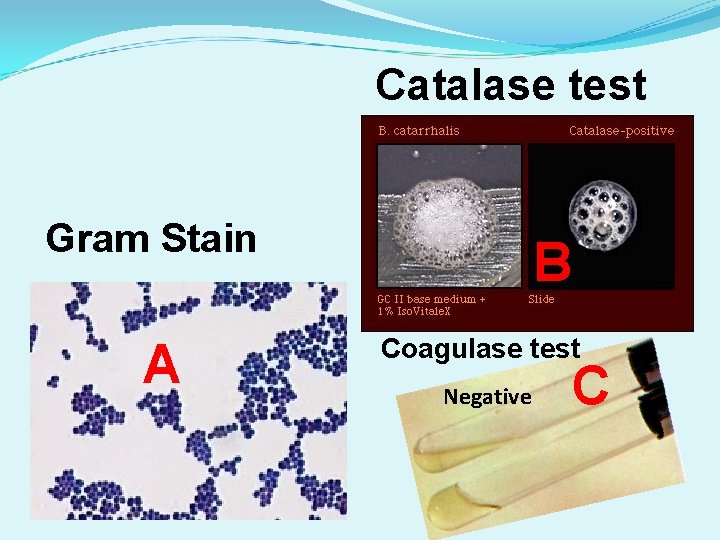 Catalase test Gram Stain A B Coagulase test Negative C Catalase test Gram Stain A B Coagulase test Negative C