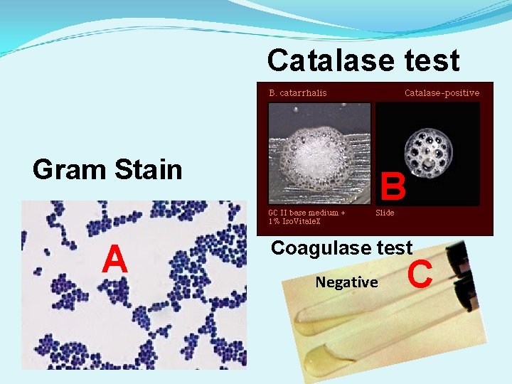 Catalase test Gram Stain A B Coagulase test Negative C 