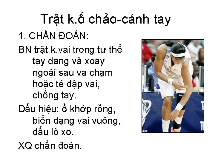 Trật k. ổ chảo-cánh tay 1. CHẨN ĐOÁN: BN trật k. vai trong tư