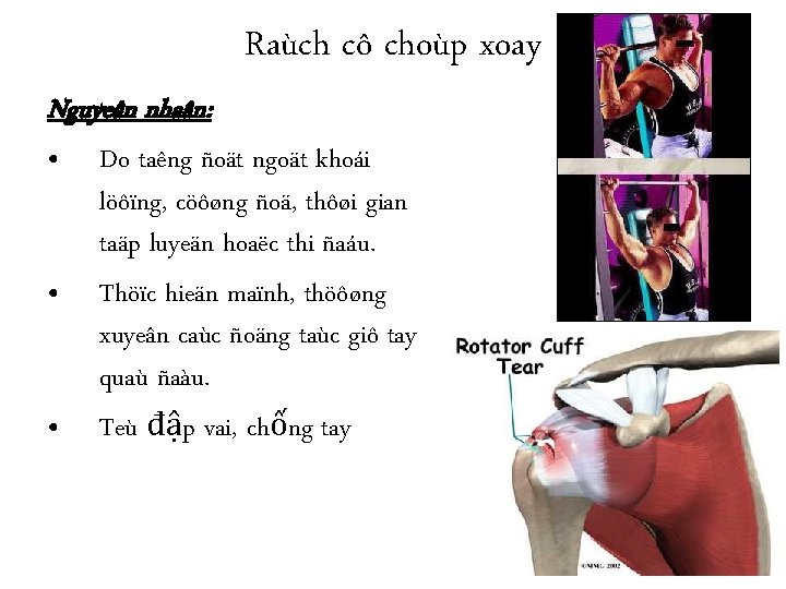 Raùch cô choùp xoay Nguyeân nhaân: • Do taêng ñoät ngoät khoái • •