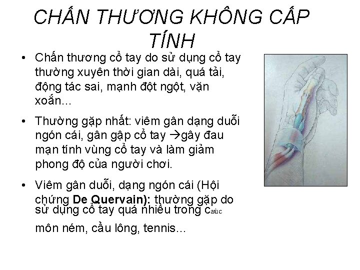 CHẤN THƯƠNG KHÔNG CẤP TÍNH • Chấn thương cổ tay do sử dụng cổ