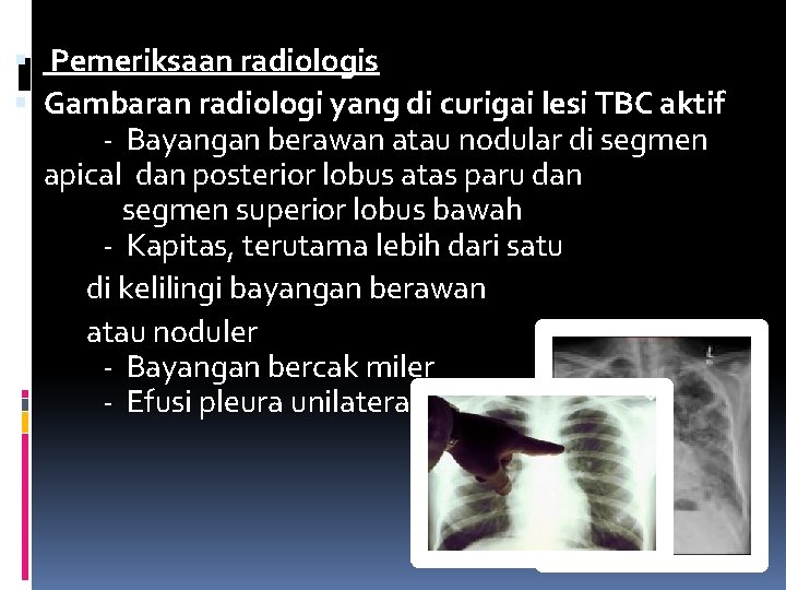  Pemeriksaan radiologis Gambaran radiologi yang di curigai lesi TBC aktif - Bayangan berawan