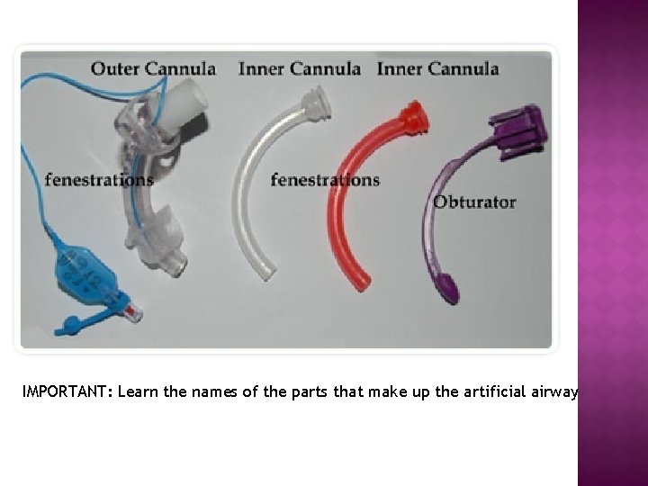 IMPORTANT: Learn the names of the parts that make up the artificial airway 