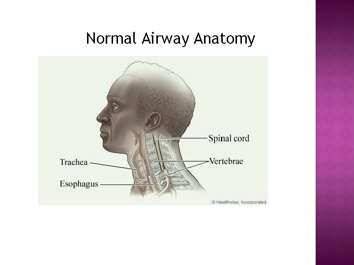 Normal Airway Anatomy 