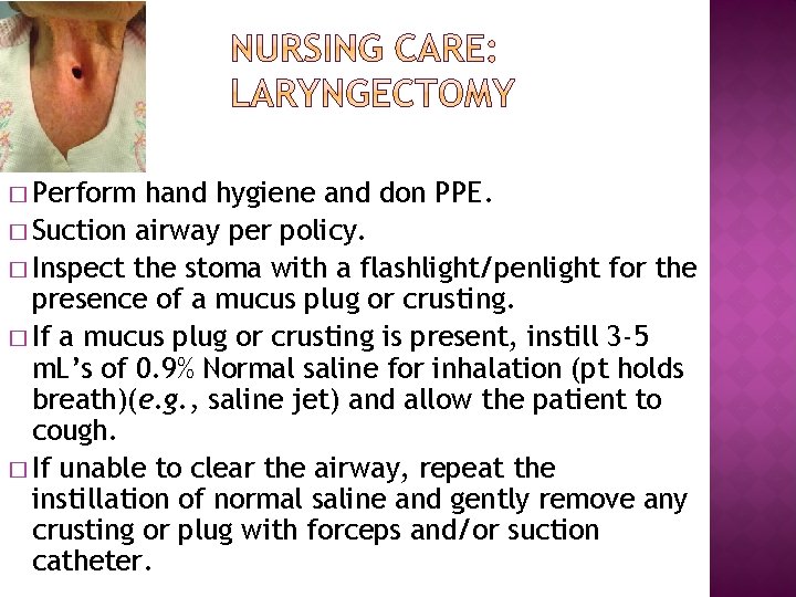 � Perform hand hygiene and don PPE. � Suction airway per policy. � Inspect