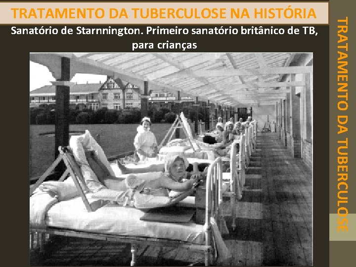 Sanatório de Starnnington. Primeiro sanatório britânico de TB, para crianças TRATAMENTO DA TUBERCULOSE NA
