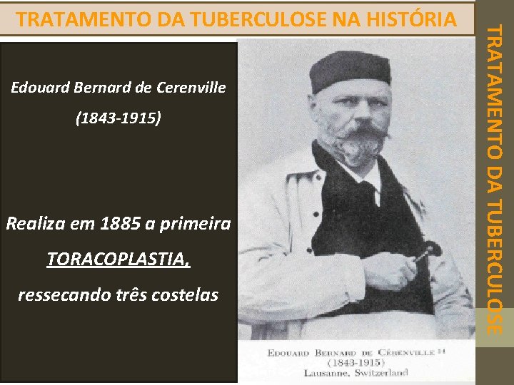 Edouard Bernard de Cerenville (1843 -1915) Realiza em 1885 a primeira TORACOPLASTIA, ressecando três