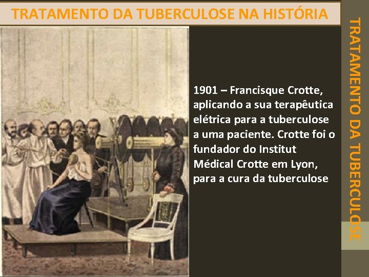 1901 – Francisque Crotte, aplicando a sua terapêutica elétrica para a tuberculose a uma