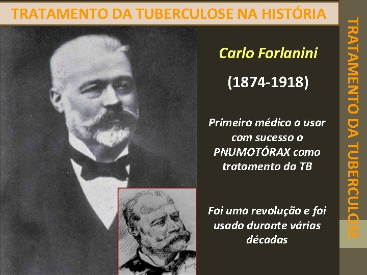 Carlo Forlanini (1874 -1918) Primeiro médico a usar com sucesso o PNUMOTÓRAX como tratamento