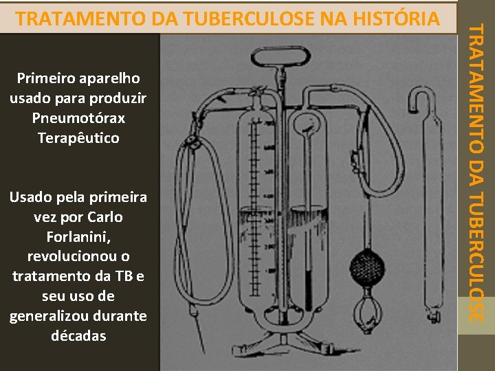 Primeiro aparelho usado para produzir Pneumotórax Terapêutico Usado pela primeira vez por Carlo Forlanini,