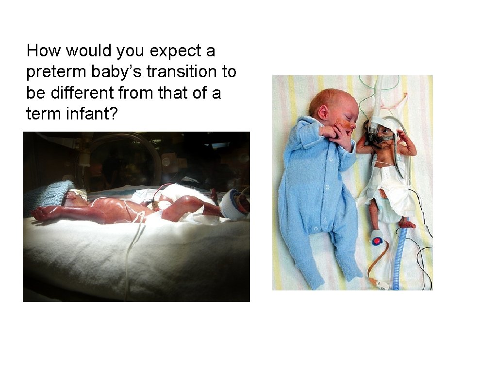 How would you expect a preterm baby’s transition to be different from that of