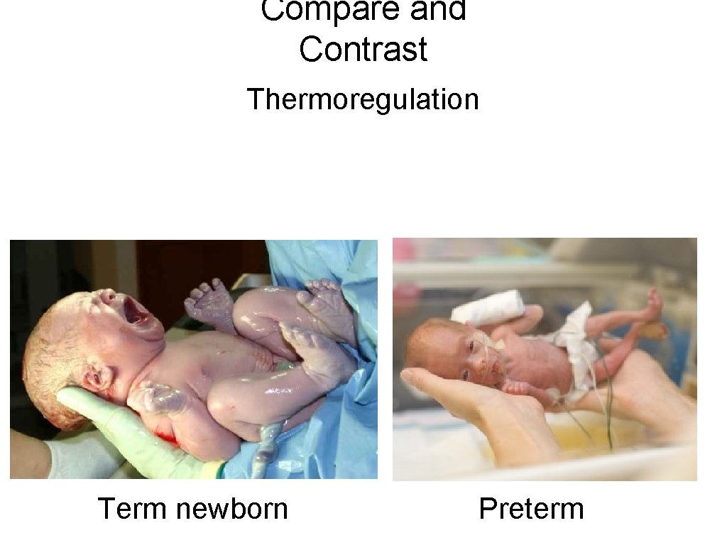 Compare and Contrast Thermoregulation Term newborn Preterm 