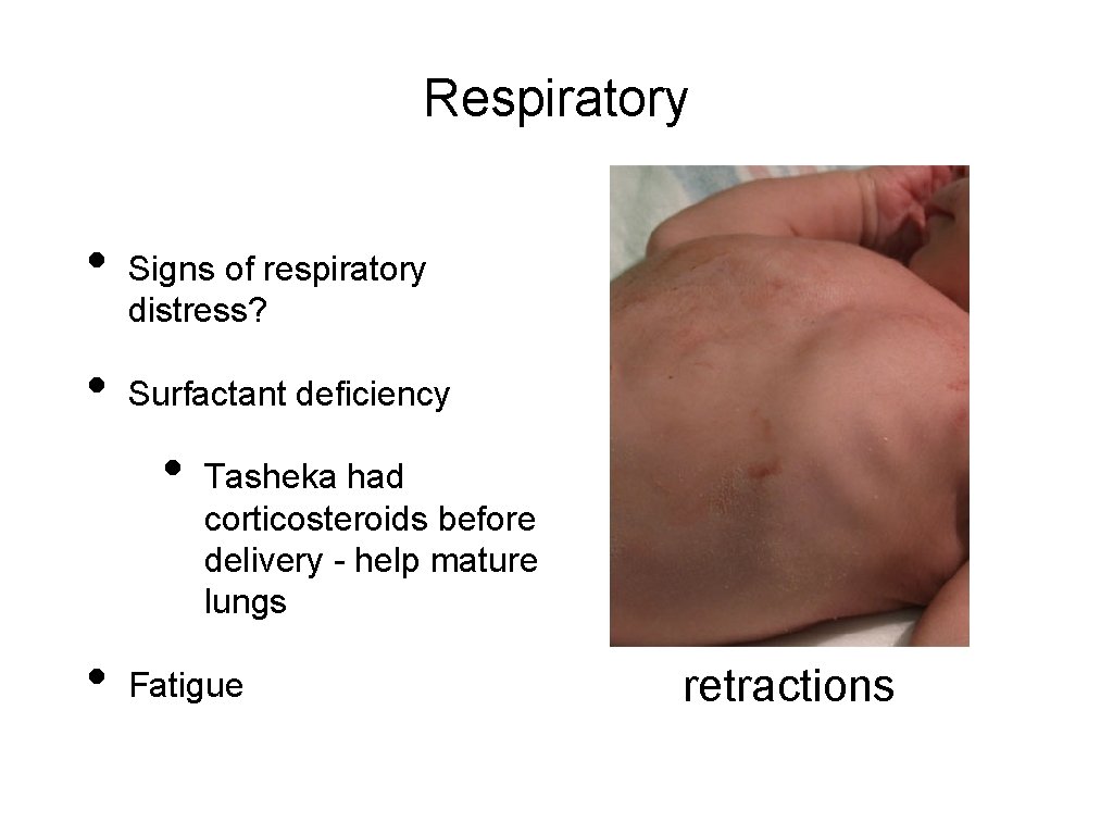Respiratory • • Signs of respiratory distress? Surfactant deficiency • • Tasheka had corticosteroids