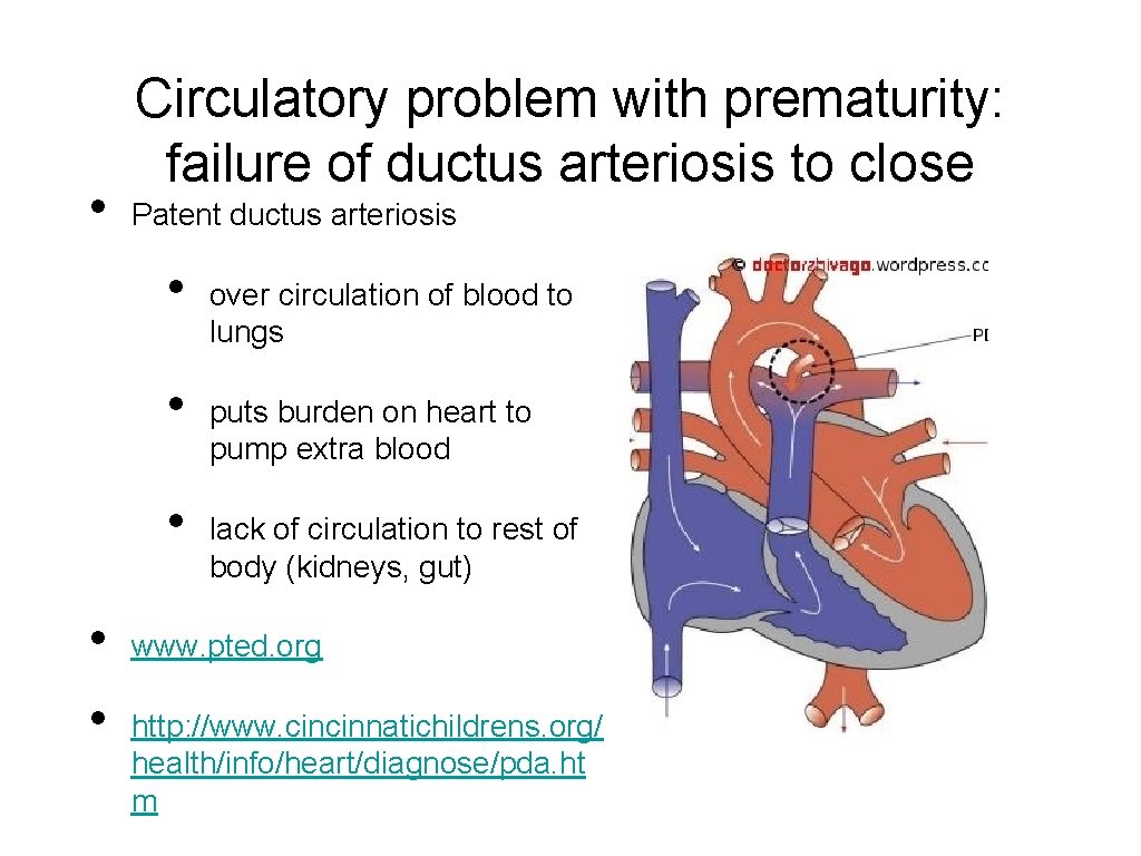  • Circulatory problem with prematurity: failure of ductus arteriosis to close Patent ductus