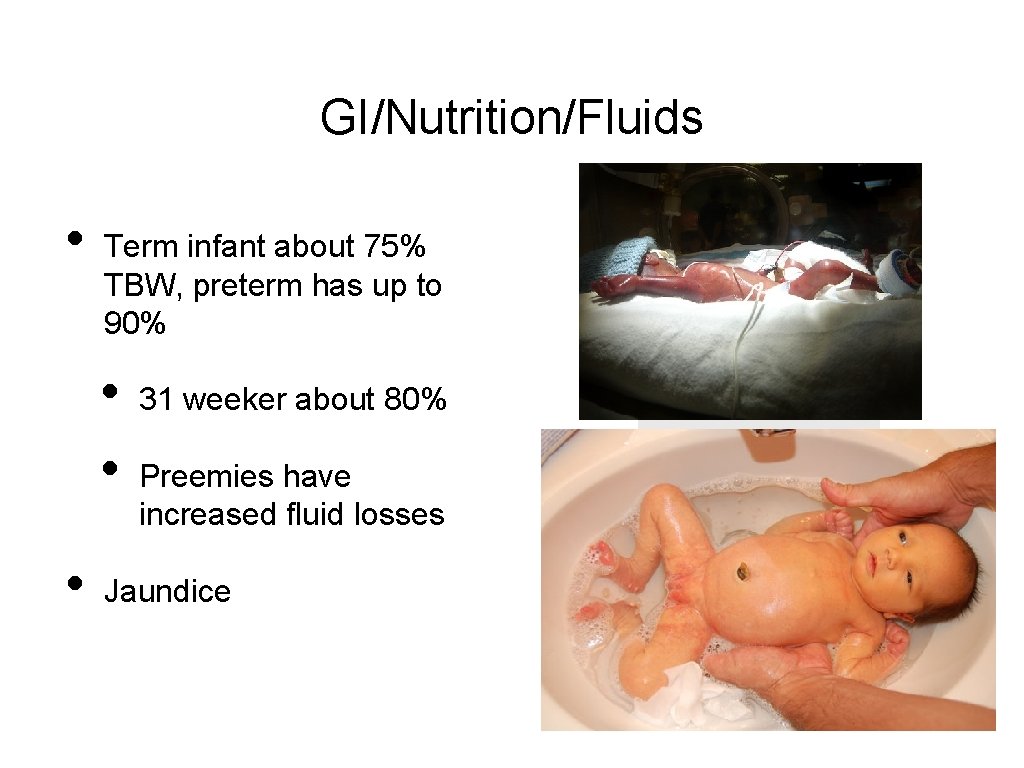 GI/Nutrition/Fluids • Term infant about 75% TBW, preterm has up to 90% • •