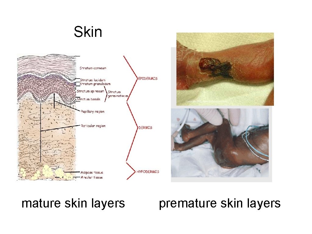Skin mature skin layers premature skin layers 