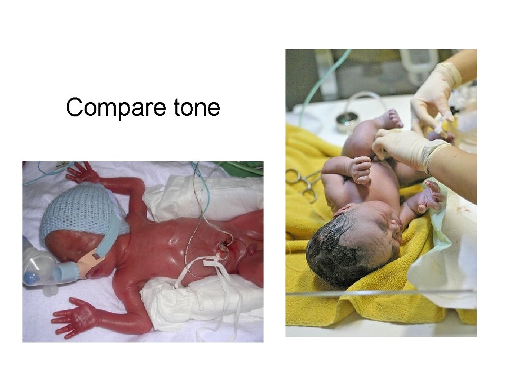 Compare tone 