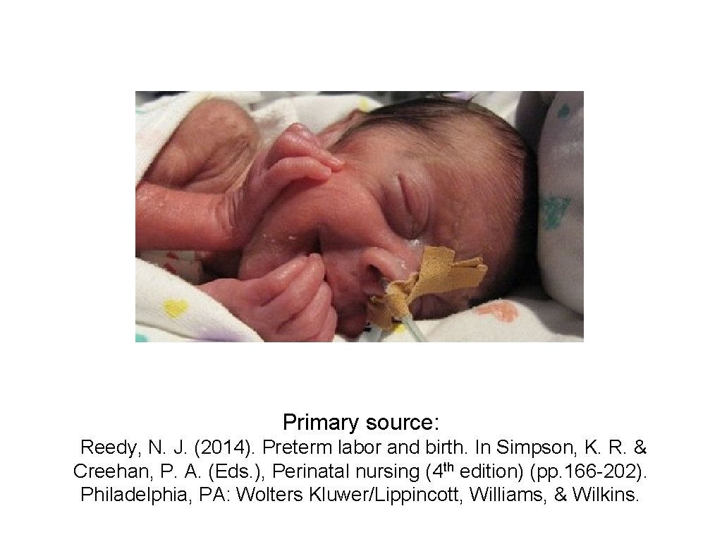 Primary source: Reedy, N. J. (2014). Preterm labor and birth. In Simpson, K. R.