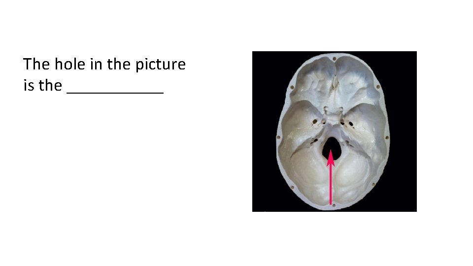 The hole in the picture is the ______ 