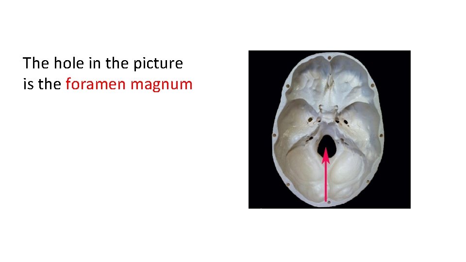 The hole in the picture is the foramen magnum 