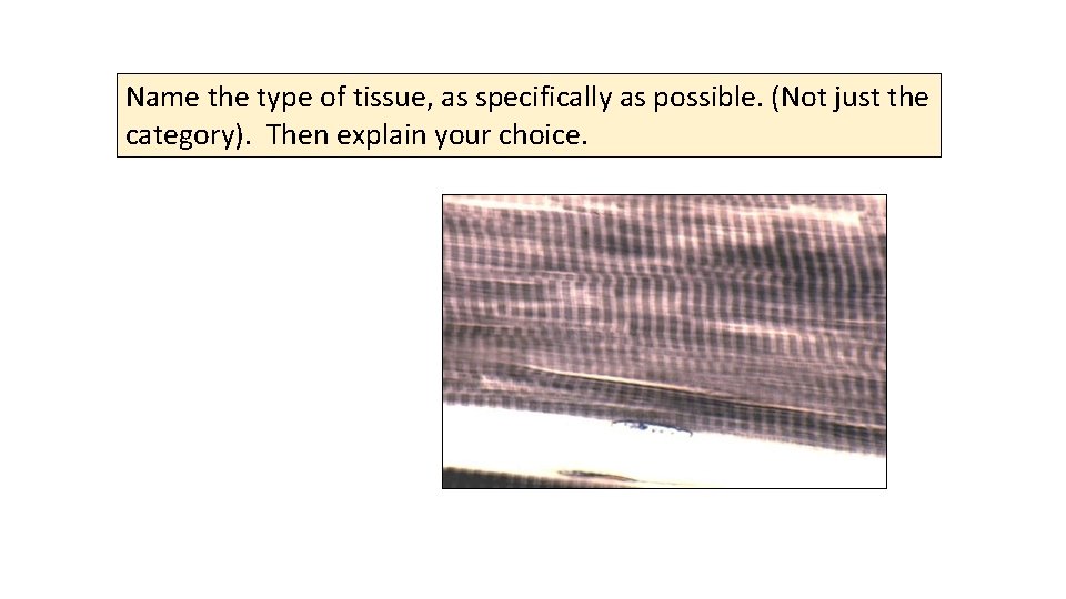 Name the type of tissue, as specifically as possible. (Not just the category). Then