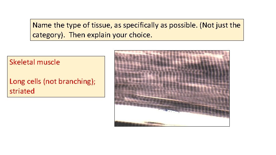 Name the type of tissue, as specifically as possible. (Not just the category). Then