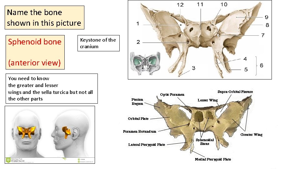 Name the bone shown in this picture Sphenoid bone Keystone of the cranium (anterior