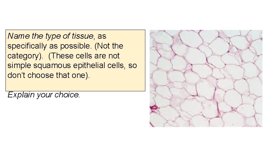 Name the type of tissue, as specifically as possible. (Not the category). (These cells