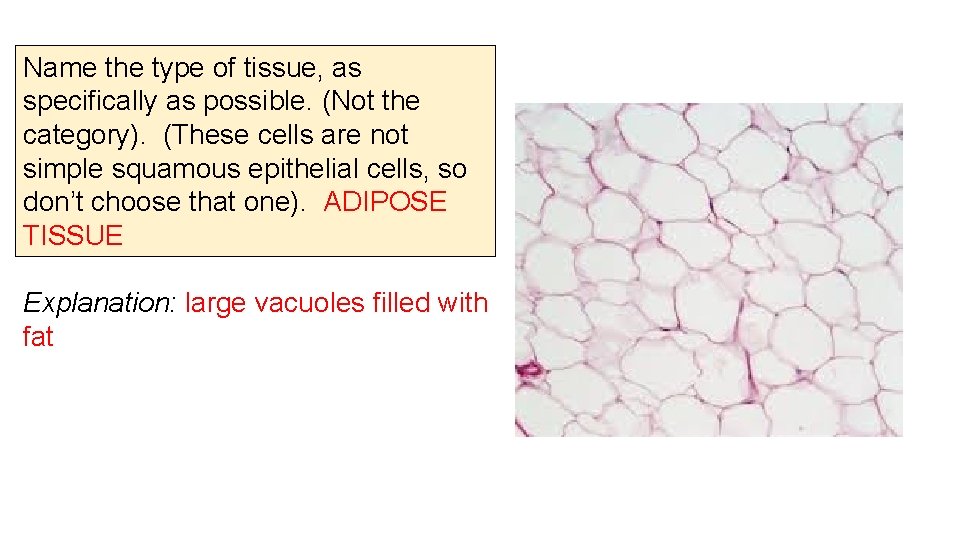 Name the type of tissue, as specifically as possible. (Not the category). (These cells