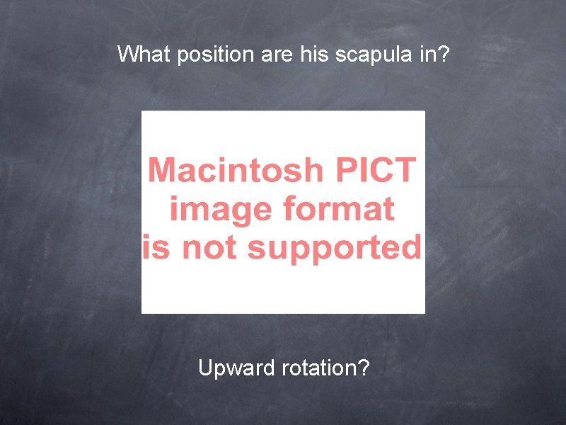 What position are his scapula in? Upward rotation? 