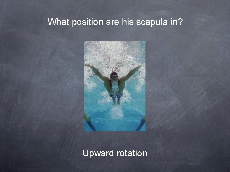 What position are his scapula in? Upward rotation 
