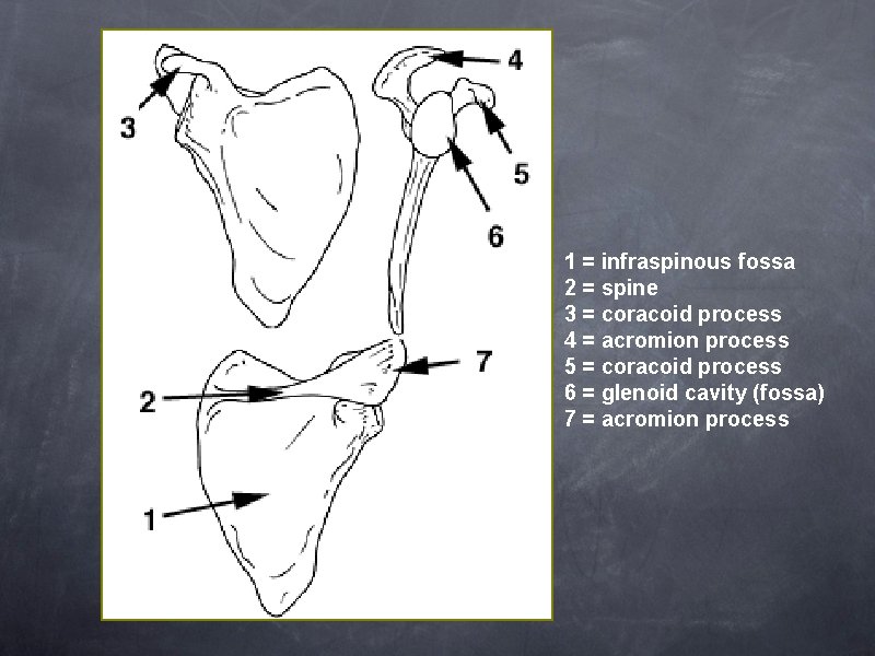 Anterior 1 = infraspinous fossa 2 = spine 3 = coracoid process 4 =