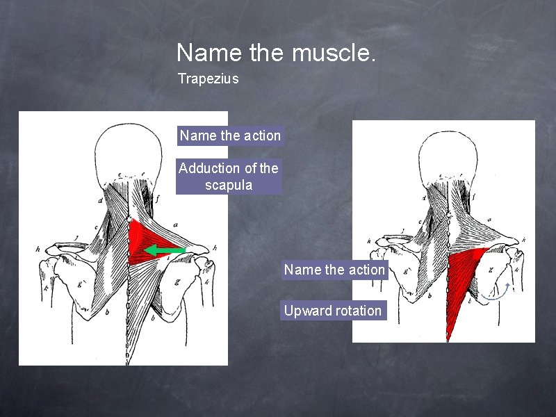 Name the muscle. Trapezius Name the action Adduction of the scapula Name the action