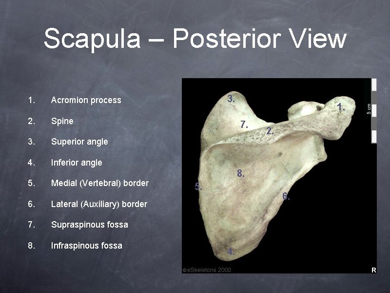 Scapula – Posterior View 1. Acromion process 2. Spine 3. Superior angle 4. Inferior
