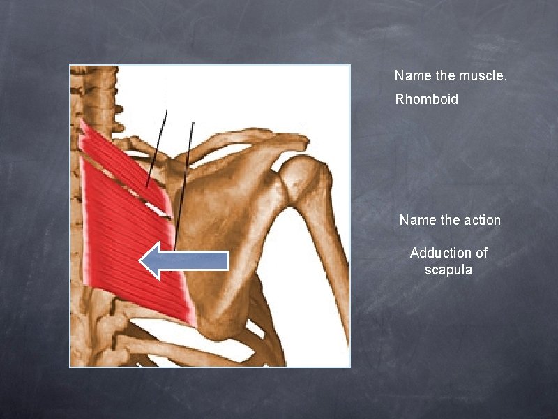 Name the muscle. Rhomboid Name the action Adduction of scapula 