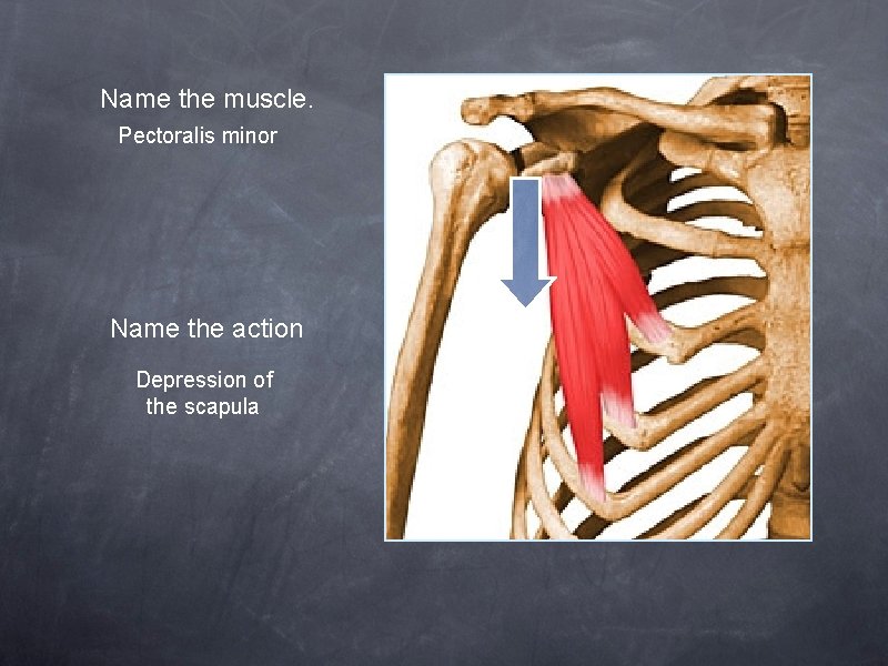 Name the muscle. Pectoralis minor Name the action Depression of the scapula 
