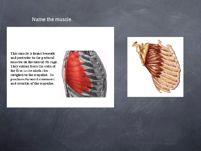 Name the muscle. 