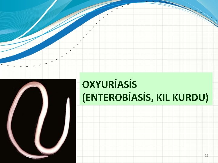 OXYURİASİS (ENTEROBİASİS, KIL KURDU) 18 