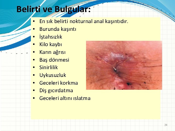 Belirti ve Bulgular: • • • En sık belirti nokturnal anal kaşıntıdır. Burunda kaşıntı