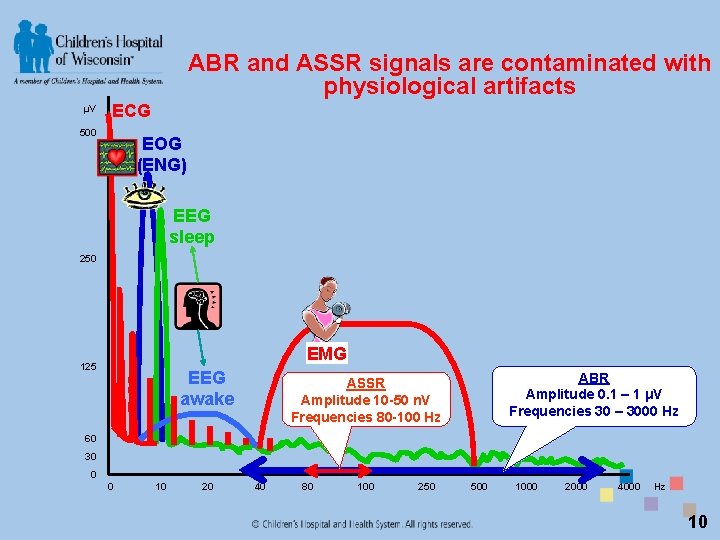 ABR and ASSR signals are contaminated with physiological artifacts µV ECG 500 EOG (ENG)