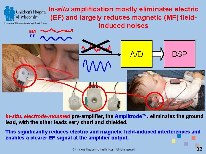 EMI EP In-situ amplification mostly eliminates electric (EF) and largely reduces magnetic (MF) fieldinduced