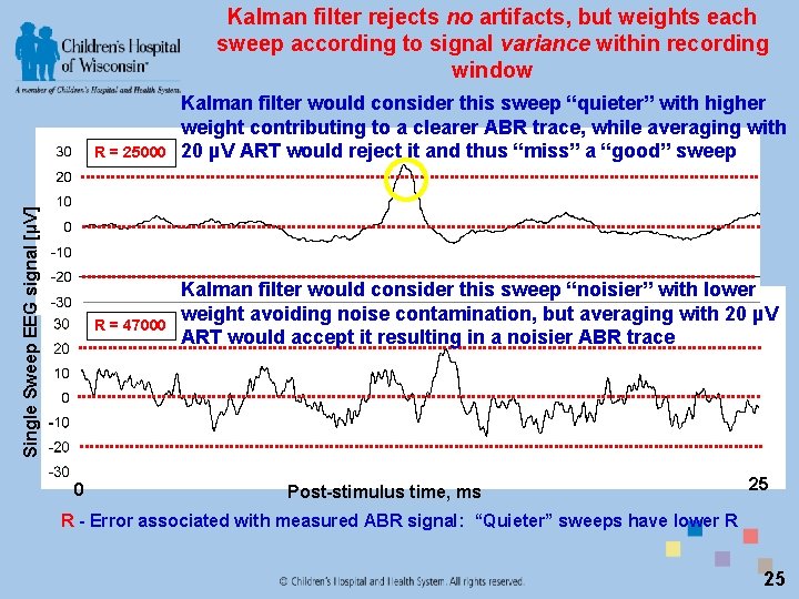 Kalman filter rejects no artifacts, but weights each sweep according to signal variance within