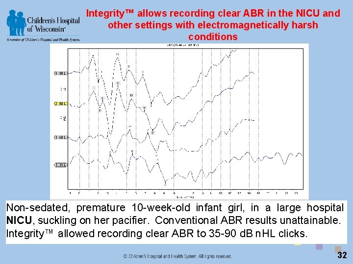 Integrity™ allows recording clear ABR in the NICU and other settings with electromagnetically harsh