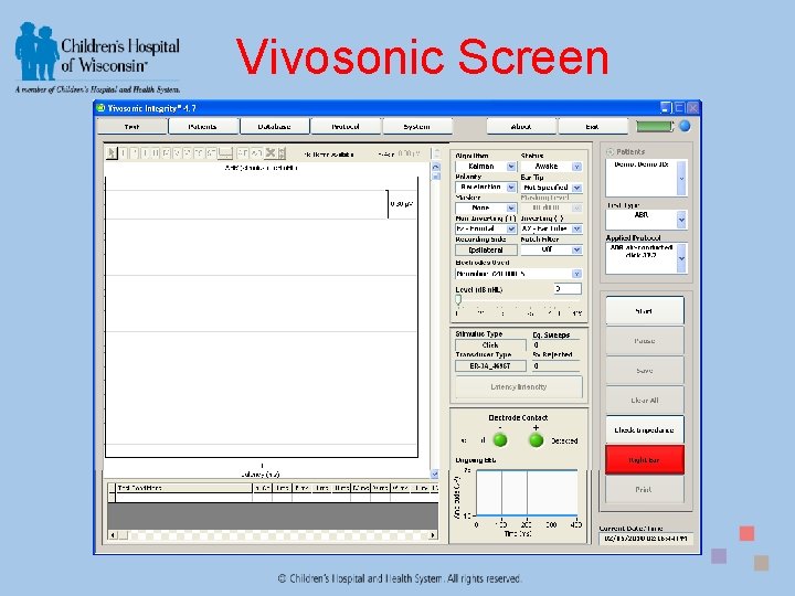 Vivosonic Screen 