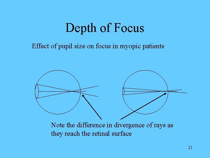 Depth of Focus Effect of pupil size on focus in myopic patients Note the
