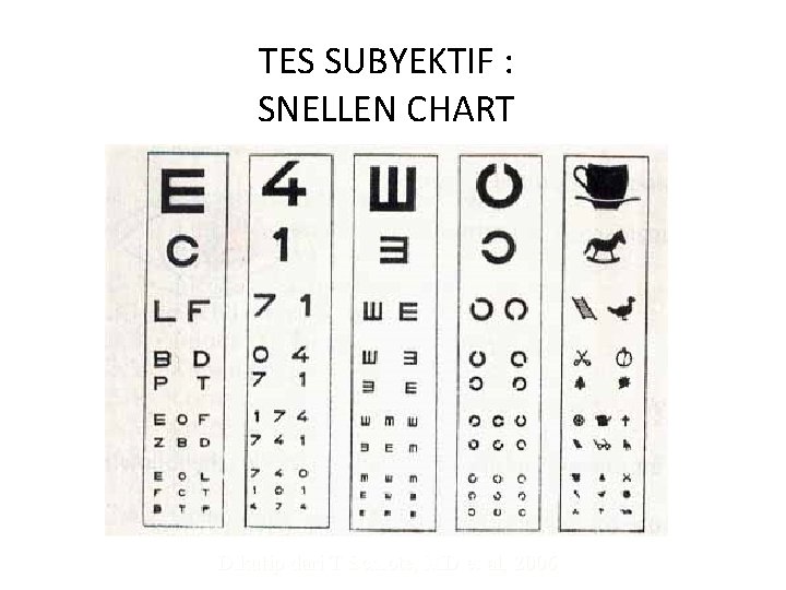 TES SUBYEKTIF : SNELLEN CHART Dikutip dari T Schlote, MD et al, 2006 