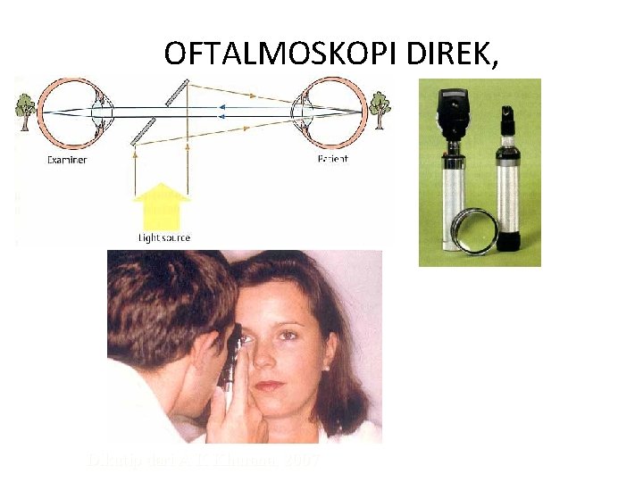 OFTALMOSKOPI DIREK, Dikutip dari A K Khurana, 2007 