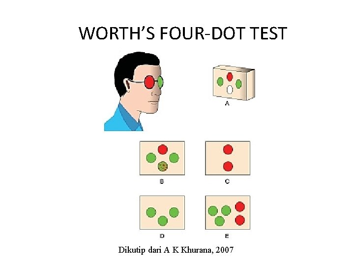 WORTH’S FOUR-DOT TEST Dikutip dari A K Khurana, 2007 