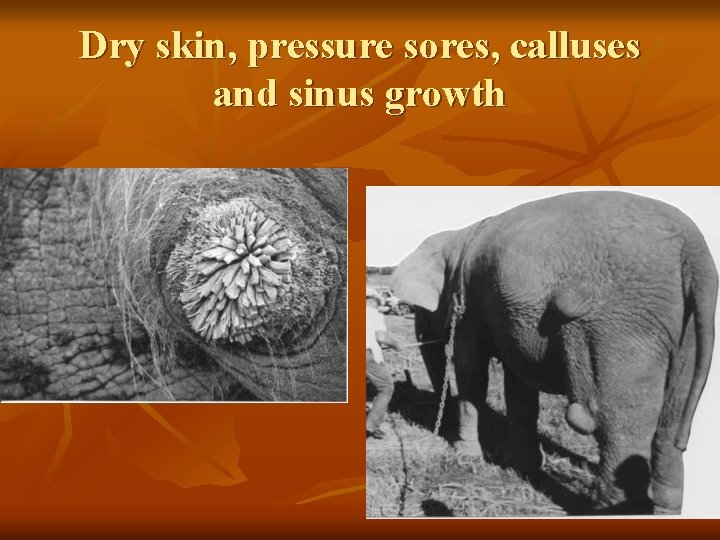 Dry skin, pressure sores, calluses and sinus growth 