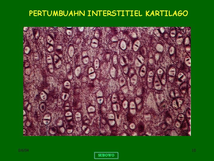 PERTUMBUAHN INTERSTITIEL KARTILAGO 8/6/04 10 SUBOWO 